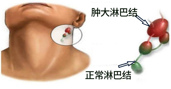 上海最大的助孕公司(查出甲状腺结节、甲状腺癌,到底要不要手术?)