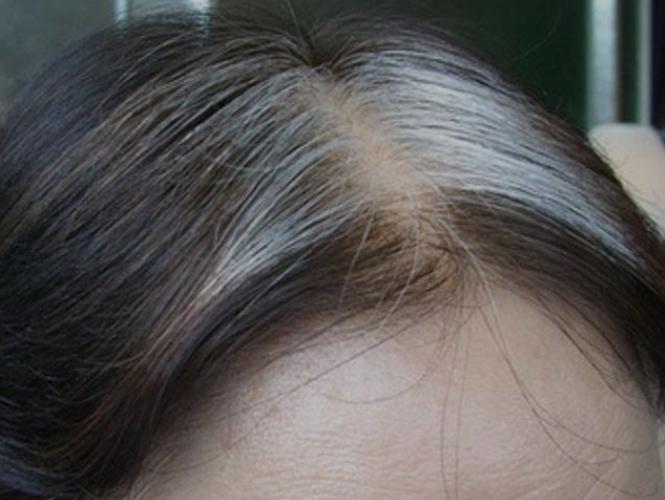 女性白头发日渐增多,先别以为自己老了,可能是缺乏3种营养休闲区蓝鸢梦想 - Www.slyday.coM 女性白头发日渐增多,先别以为自己老了,可能是缺乏3种营养休闲区蓝鸢梦想 - Www.slyday.coM