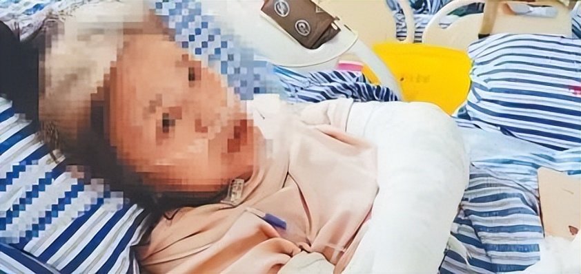 九江一女子被狗撕咬成重伤,江西省胸科医院4小时手术救治休闲区蓝鸢梦想 - Www.slyday.coM 九江一女子被狗撕咬成重伤,江西省胸科医院4小时手术救治休闲区蓝鸢梦想 - Www.slyday.coM