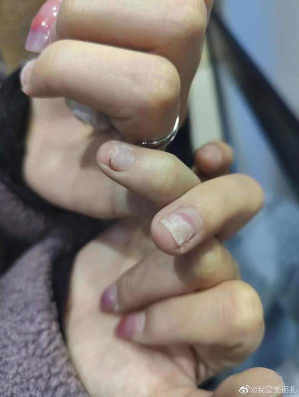 家属回应“女子爆料遭球员殴打”:球员曾愿道歉后反悔 自称不便公开道歉休闲区蓝鸢梦想 - Www.slyday.coM 家属回应“女子爆料遭球员殴打”:球员曾愿道歉后反悔 自称不便公开道歉休闲区蓝鸢梦想 - Www.slyday.coM