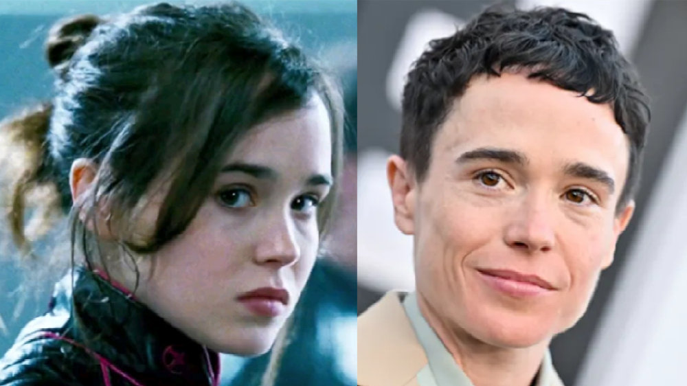 《X战警》重聚，女主变男人！变性后晒手术伤疤，曾主演盗梦空间