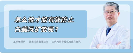 怎么做才能有效防止白癜风扩散呢？