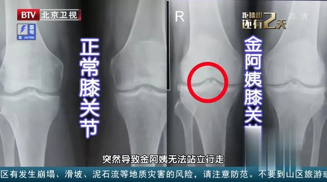 筋长一寸,寿延十年!1分钟自测筋骨柔韧性!简单2招让你柔筋提气休闲区蓝鸢梦想 - Www.slyday.coM 筋长一寸,寿延十年!1分钟自测筋骨柔韧性!简单2招让你柔筋提气休闲区蓝鸢梦想 - Www.slyday.coM