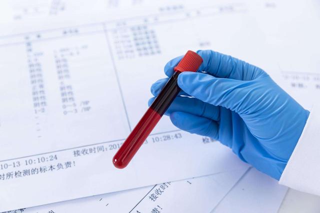 易饿吃多常疲惫,可能是糖尿病征兆,体检遵医嘱两大原则,降风险休闲区蓝鸢梦想 - Www.slyday.coM 易饿吃多常疲惫,可能是糖尿病征兆,体检遵医嘱两大原则,降风险休闲区蓝鸢梦想 - Www.slyday.coM