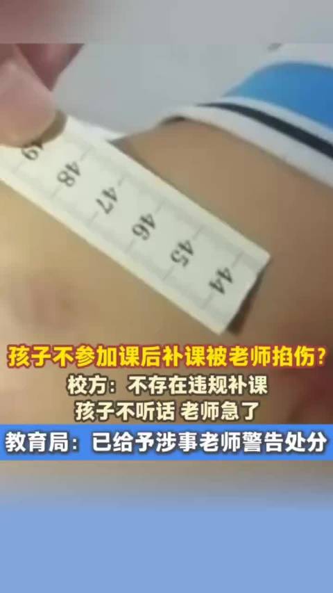 学生未补课被老师掐伤，校方称系孩子不听话，涉事教师受警告处分