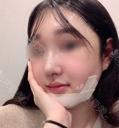 下颚线不明显，听说<a href=