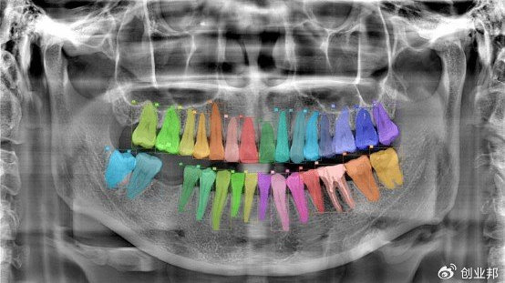 登特菲 ：数字化打造口腔医疗新生态