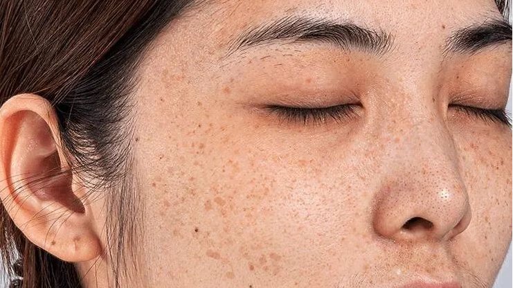 晶世容颜美白祛斑贴效果如何 祛斑贴正确使用方法