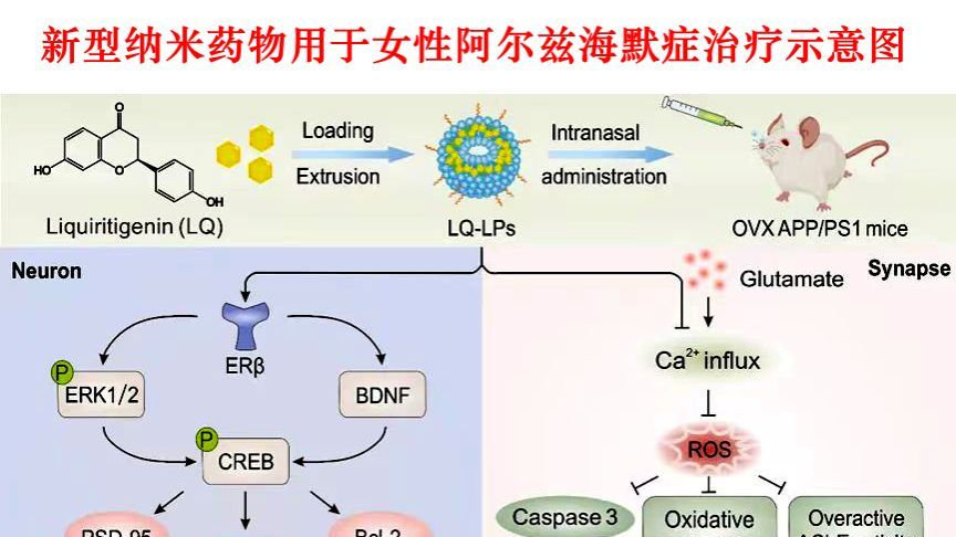 守护“她健康” 我校研发阿尔兹海默症女性特异性药物