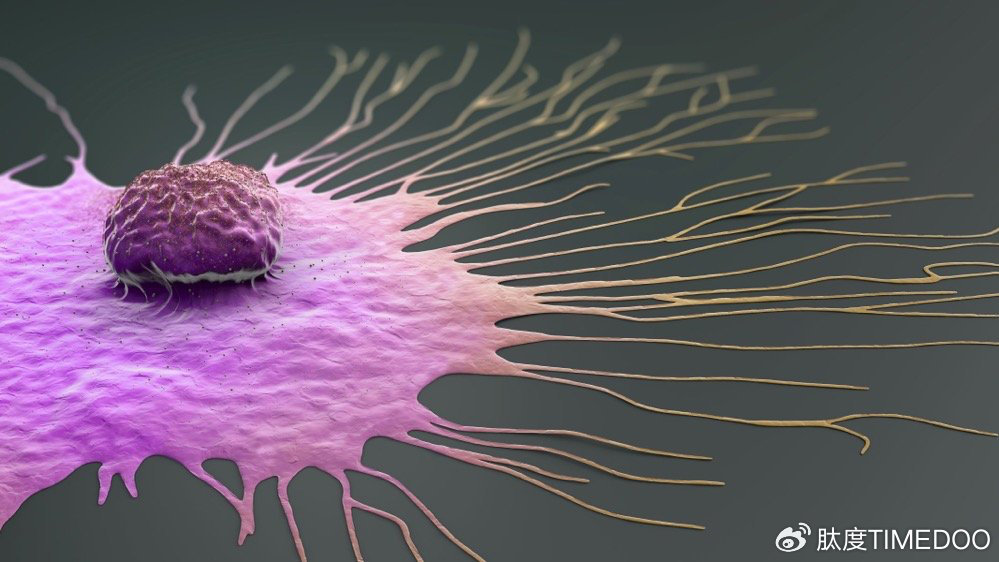 乳腺癌细胞新机制揭示：基质摄取成为潜在治疗靶点
