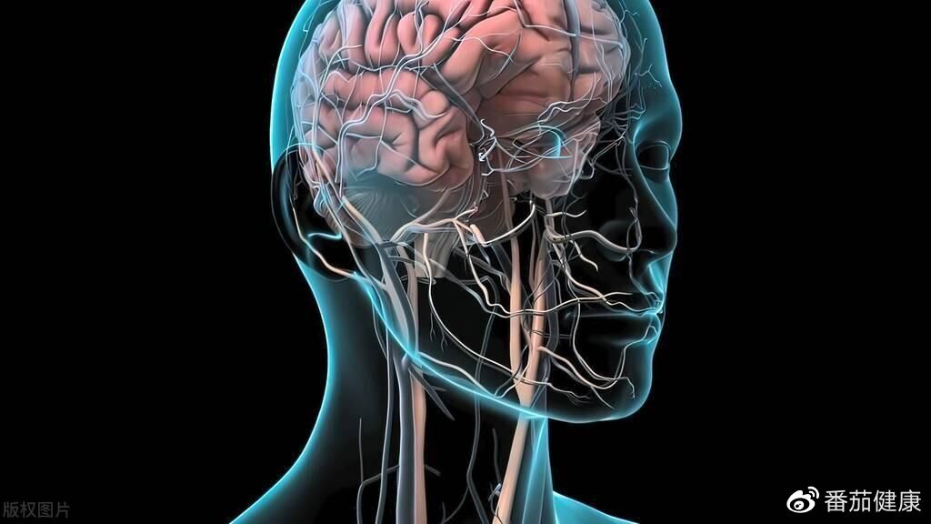 为什么高血压会引起脑出血?