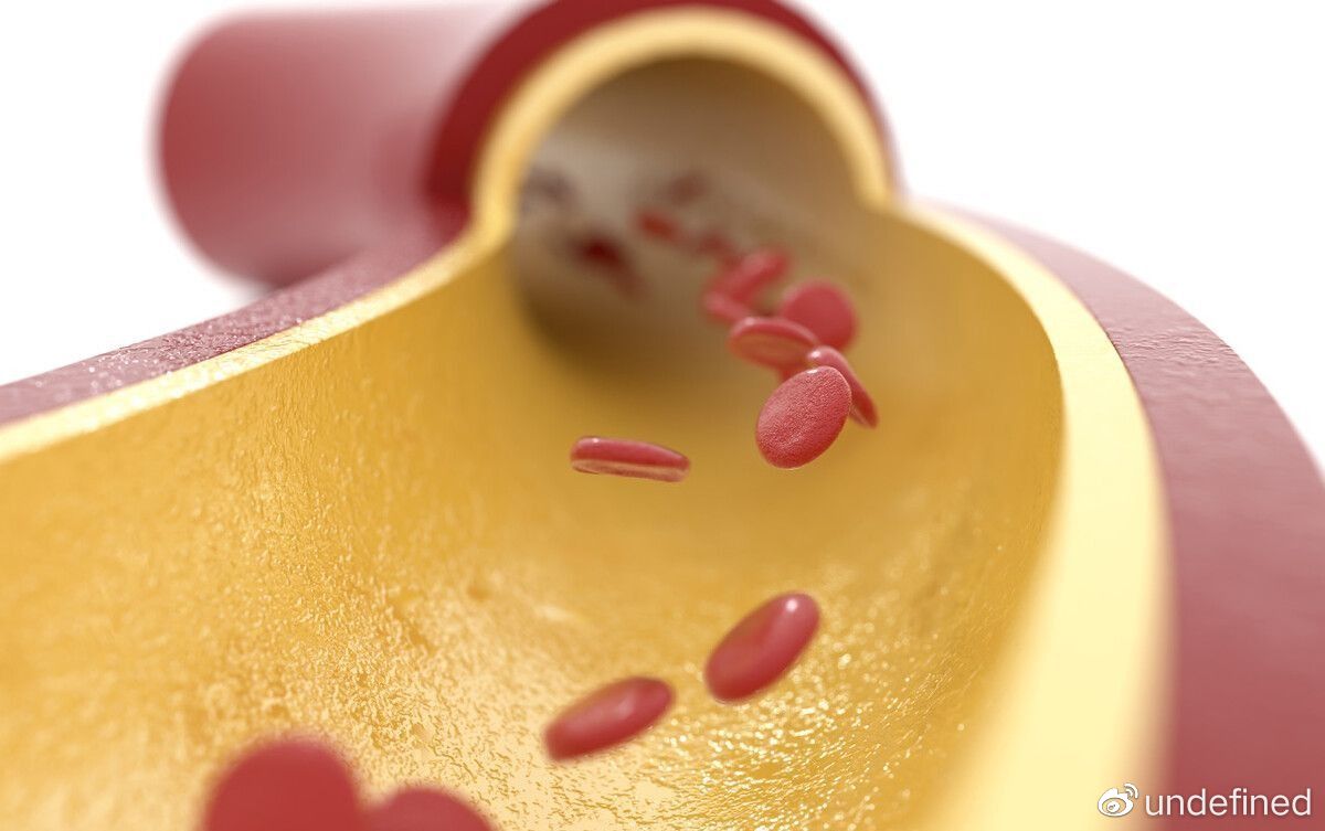 血液“干净”的人，一般会有4个特征，若你都有，身体很健康休闲区蓝鸢梦想 - Www.slyday.coM