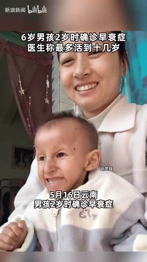 6岁男孩2岁时确诊早衰症，医生称最多活到十几岁