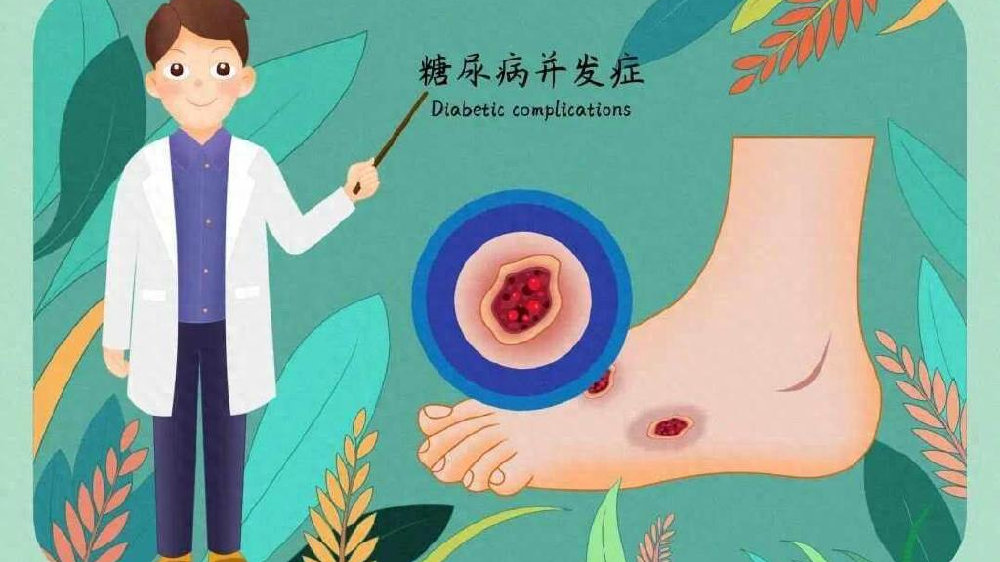 糖尿病足早期症状有哪些 糖尿病足最明显的症状是什么