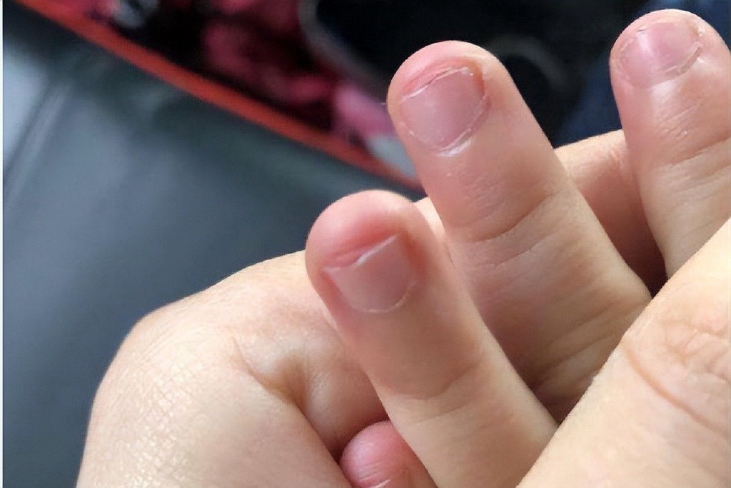 啃指甲的背后：命运线的恐怖预兆？探寻习惯与运势的关联