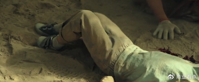 像《平凡英雄》里小麦那种断臂的情况,接上以后真的还能用吗?休闲区蓝鸢梦想 - Www.slyday.coM 像《平凡英雄》里小麦那种断臂的情况,接上以后真的还能用吗?休闲区蓝鸢梦想 - Www.slyday.coM