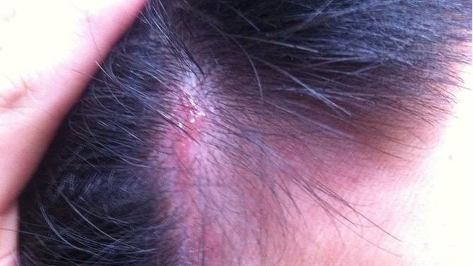 为什么会失眠睡不着觉？