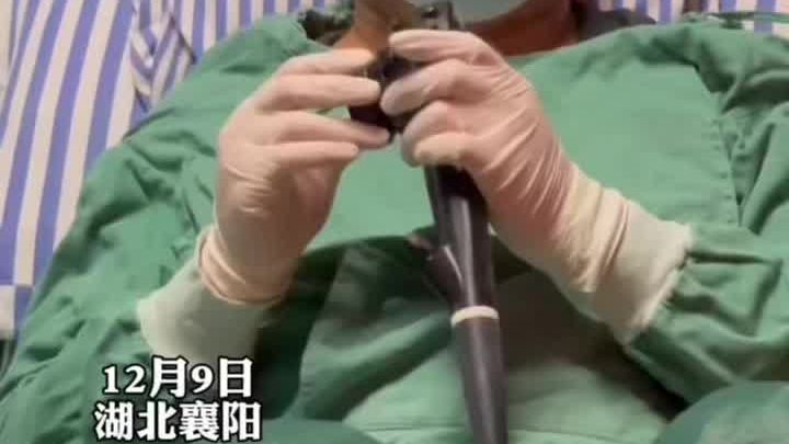 为测试肠镜检查有多痛苦，肛肠科医生给自己做肠镜亲身体验，做完后自己回病房。 医生 肛肠 肛肠检查|医生|肛肠|病房_新浪新闻