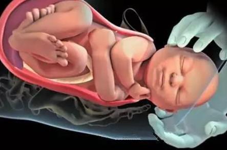 胎儿那么大,产道那么小,宝宝是如何出来的?