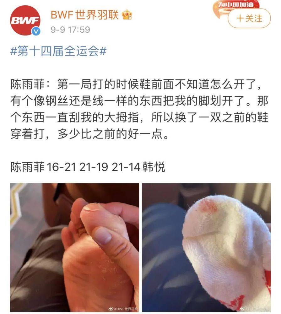 奥运冠军陈雨菲比赛被运动鞋割伤脚趾,李宁回应休闲区蓝鸢梦想 - Www.slyday.coM 奥运冠军陈雨菲比赛被运动鞋割伤脚趾,李宁回应休闲区蓝鸢梦想 - Www.slyday.coM