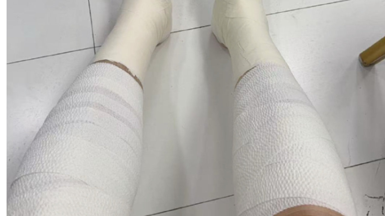 太硬了！翟晓川双腿缠满绷带罚球制胜 5人伤停许利民盛赞全队坚韧