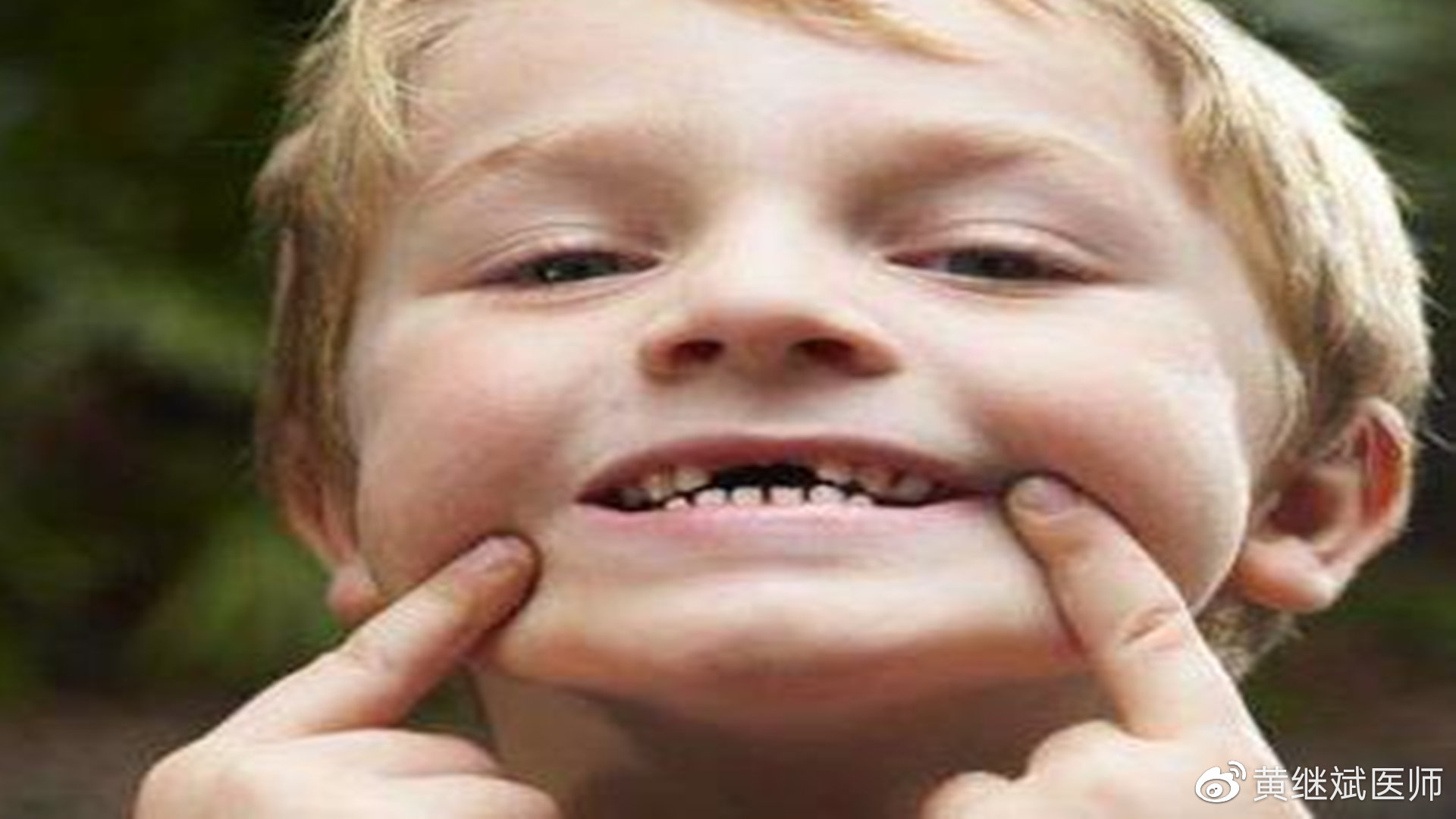 儿童换牙齿顺序图 儿童换牙齿时间-万县网