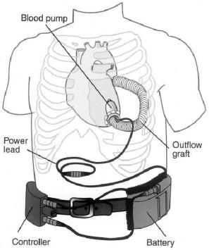 他没有心跳和脉搏,却跟正常人一样生活了7年休闲区蓝鸢梦想 - Www.slyday.coM 他没有心跳和脉搏,却跟正常人一样生活了7年休闲区蓝鸢梦想 - Www.slyday.coM