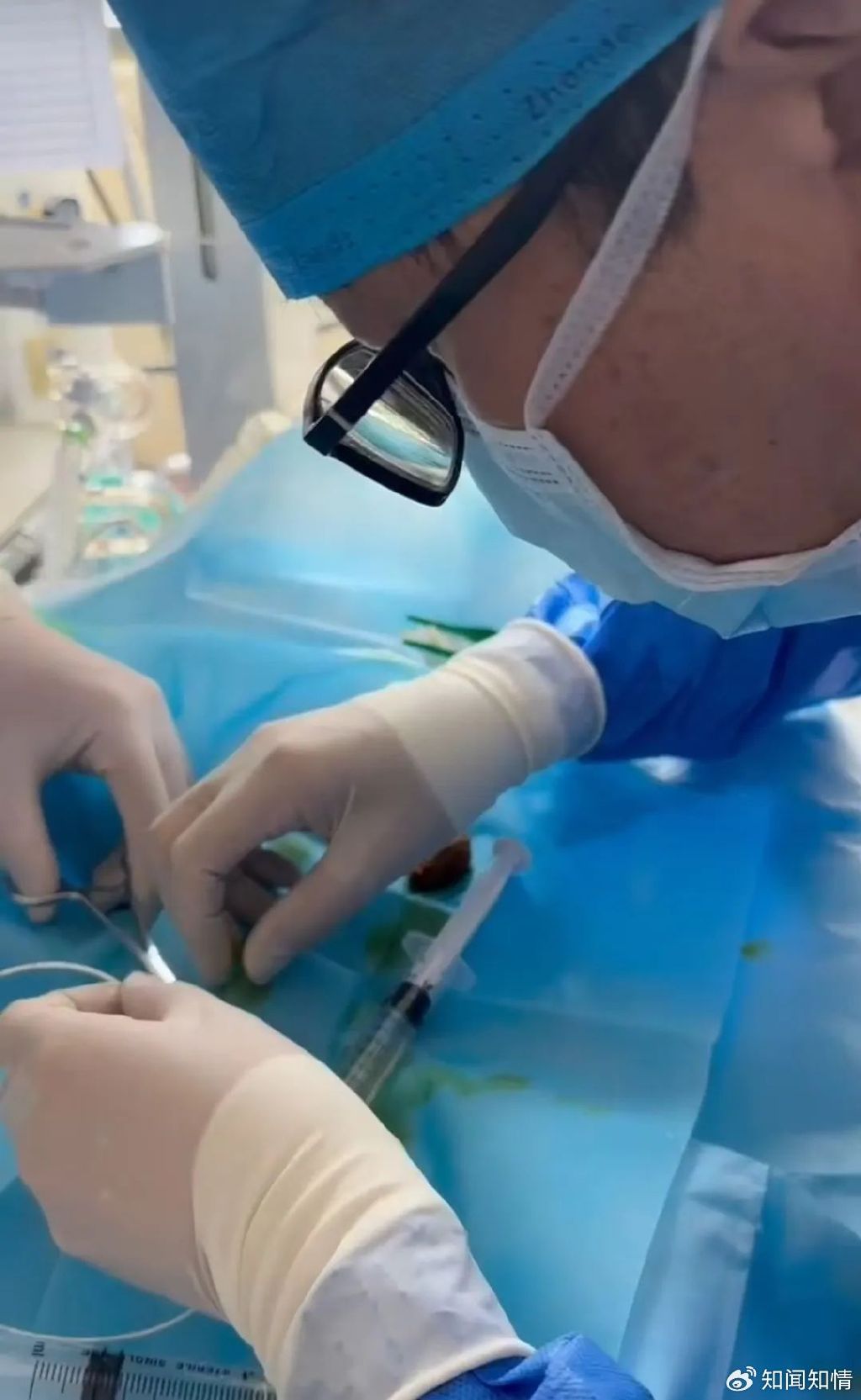 泰安妇幼保健院：28周双胞胎早产儿的生命通道争夺战