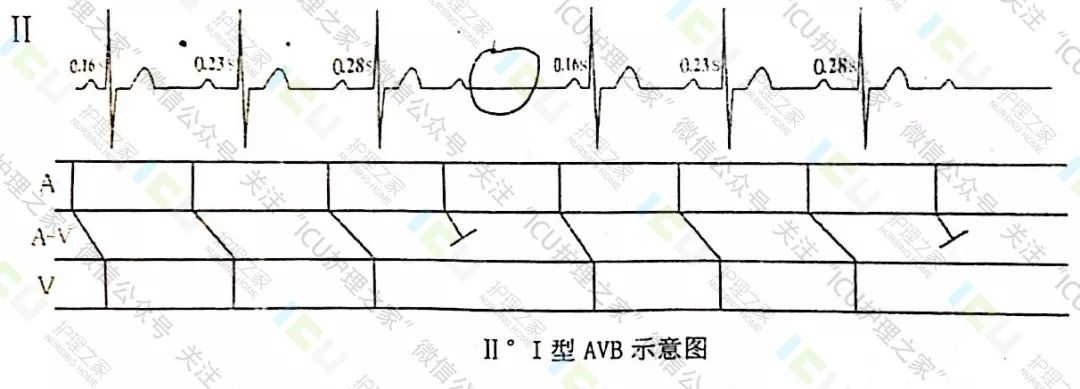 心电图读图五步法