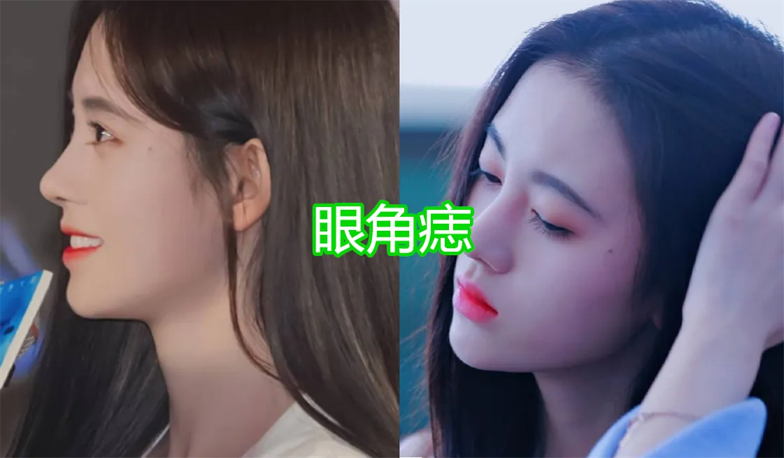 有种"优秀"叫女星脸上的痣,关晓彤唇上痣还好,看到鞠婧祎
