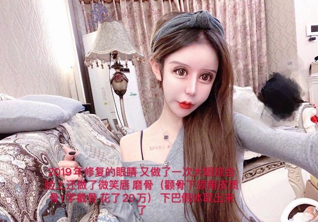 网红女13岁就整容,花百万成功"换头"成"芭比",妈妈:我