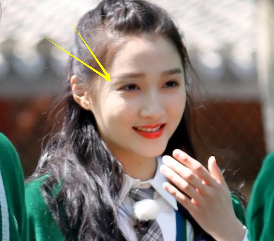 跑男第一期真莽,杨颖长一颗大黑痣,再看关晓彤,怀疑眼睛!