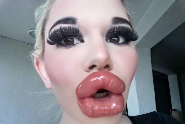 保加利亚美女丰唇20次,自称拥有世界上最大的嘴唇
