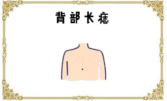 身体藏有5颗"富贵"痣,颗颗都带钱,个个腰缠万贯