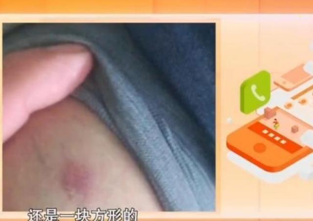 外卖骑手上门送餐,却被屋内宠物狗咬伤?狗主人:没牙印不算咬