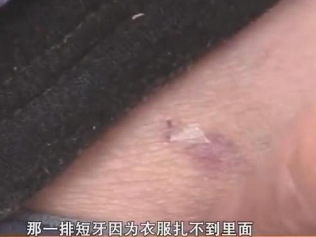 外卖骑手上门送餐,却被屋内宠物狗咬伤?狗主人:没牙印不算咬