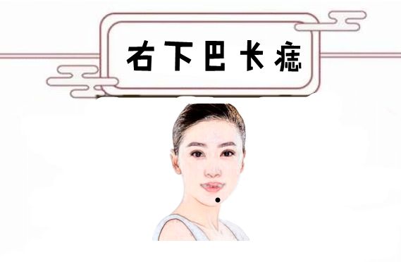 女人4颗"金贵痣,十人九富,出生好,嫁的也好