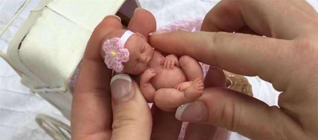 世界上最小的婴儿,体重仅280克,只有圆珠笔大小!