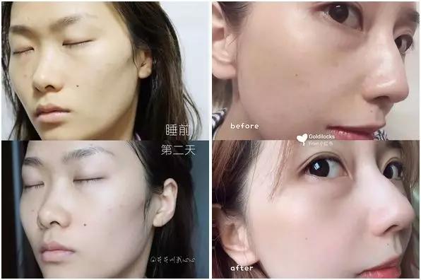 你其实不黑,只是皮肤暗沉而已