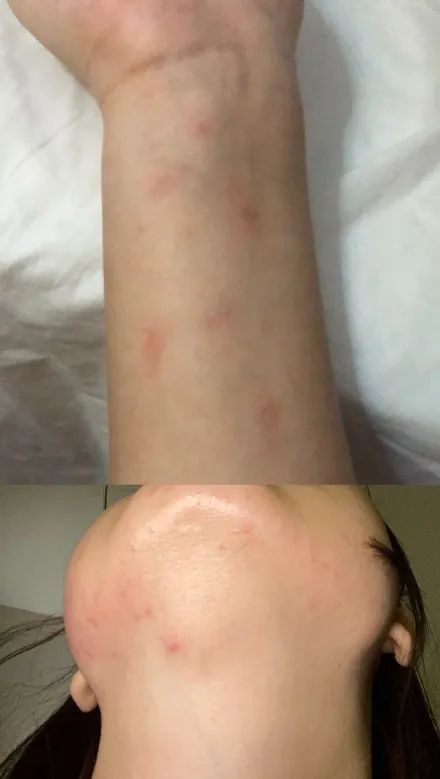 留学生回国遭遇卫生不过关隔离酒店，想回国什么时候成了原罪？