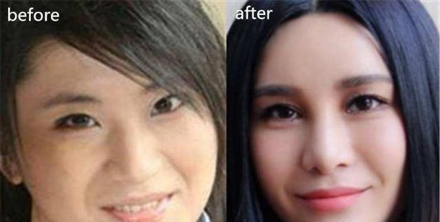 过度依赖“玻尿酸”!萧亚轩等女星的肿脸泡谁家强?生图太吓人
