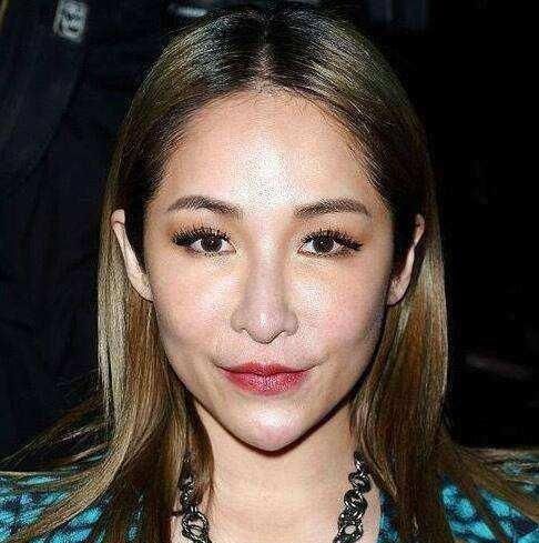 过度依赖“玻尿酸”!萧亚轩等女星的肿脸泡谁家强?生图太吓人