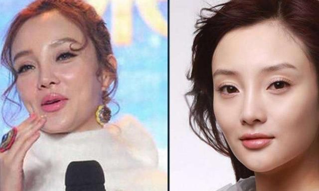 过度依赖“玻尿酸”!萧亚轩等女星的肿脸泡谁家强?生图太吓人