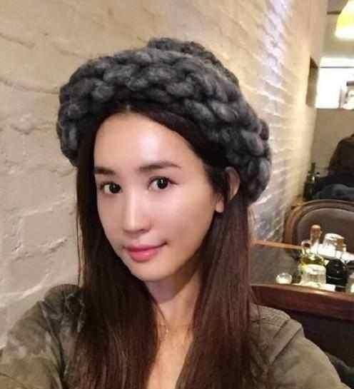 过度依赖“玻尿酸”!萧亚轩等女星的肿脸泡谁家强?生图太吓人