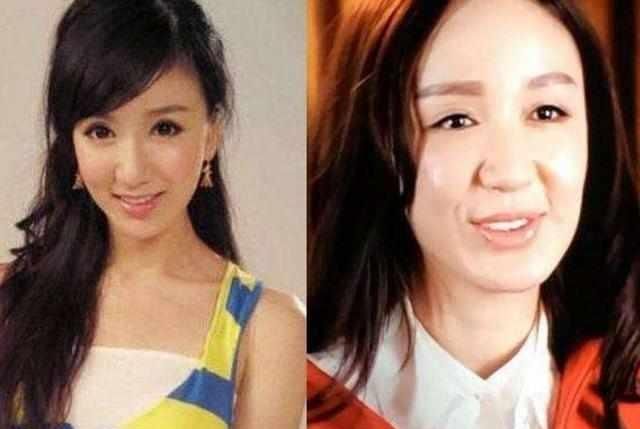 过度依赖“玻尿酸”!萧亚轩等女星的肿脸泡谁家强?生图太吓人