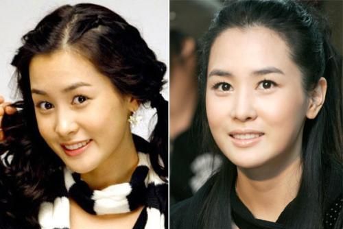 过度依赖“玻尿酸”!萧亚轩等女星的肿脸泡谁家强?生图太吓人