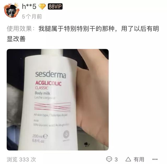 吴昕的小腿进化史,应该被写进减肥教材吧