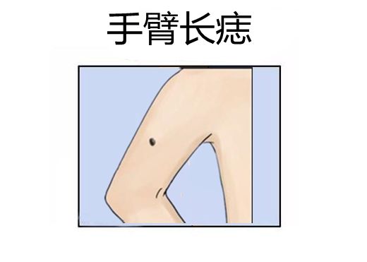黄金痣,身体5大富贵痣,一个比一个有钱,个个成龙成凤