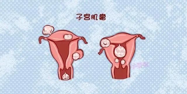 月经只有两天量还少是什么原因?
