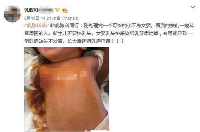 19岁少女乳头一直没长出来,不要听信"老人言",这种错误犯不得